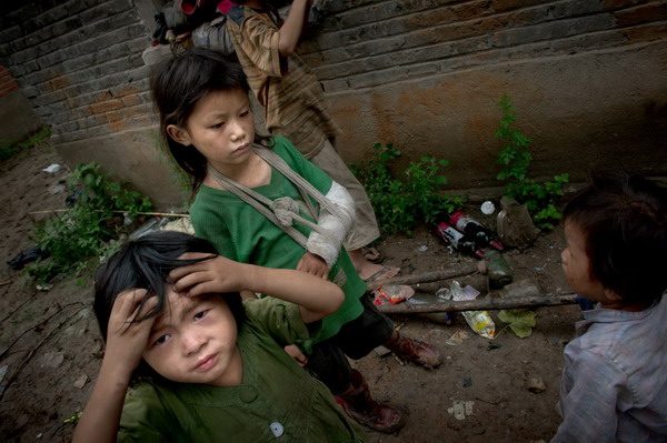 10-year-old Sun Caiyu (center) and her siblings pose for a picture in Woyang county, East China's Anhui province, July 27, 2011. Caiyun broke her arm while playing. The treatment cost several hundred yuan, which could have supported the family's meals for about a month. [Photo/Xinhua] 