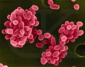 Brucellosis is a zoonotic infection transmitted from animals to humans by ingestion of infected food products