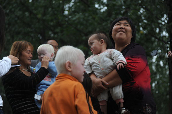 Yuan Lihai, right, holds a baby born with a harelip in Lankao county, Central China's Henan province, Sept 7, 2011.