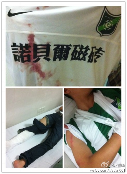  A Lvcheng fan was injured during the violence. [Source:weibo]