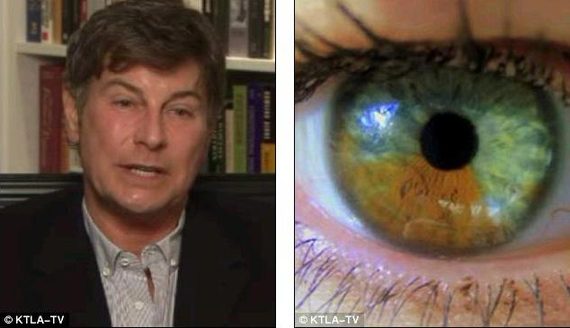 Dr Gregg Homer (left) has developed the technology over 10 years and submitted a patent for the laser eye-pigment changer in 2005. Right - An eye towards the end of treatment.