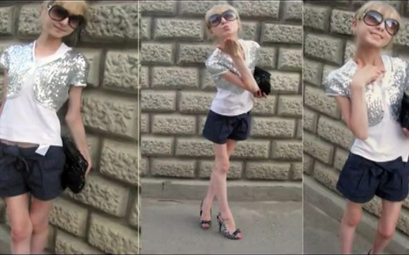 20-year-old Russian girl loses weight to 20 kg 