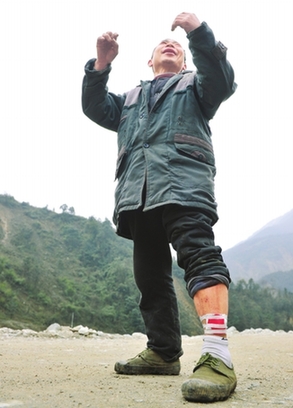 Liu Yunkang, a 59-year-old farmer from Nanyue village in Dujiangyan, Sichuan province, was bitten by a panda on March 16. [newssc.net]