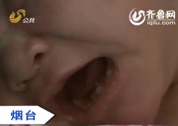Baby born with teeth