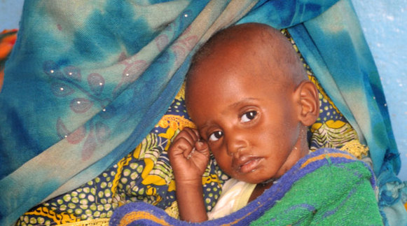 A mother with her severely malnourished child in the Sahel region. [UNICEF]