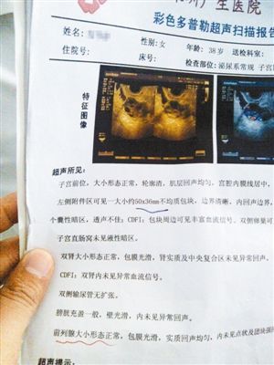 A woman in Shenzhen was told her 'prostate was healthy' as her medical result showed.
