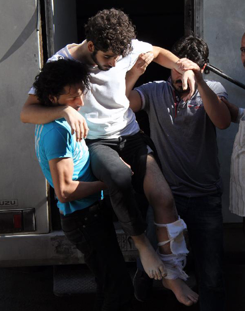 An injured detainees is carried out of a vehicle upon his release in Damascus, Syria on 11 July 2012. 