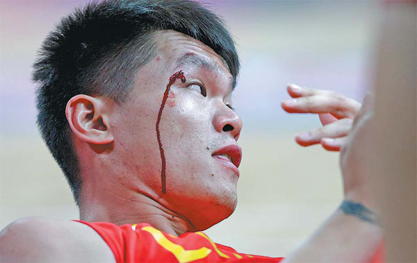 Blood runs down the face of China's Zhu Fangyu after he collided with another player during a basketball game against Australia at the London Olympic Games on Thursday. Australia won 81-61. China has failed to claim a single victory in its first three group matches, all but killing its hopes of advancing. [China Daily via Agencies]