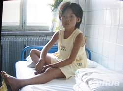 At 8 years old, Gao Ming was exposed to mustard gas that had leaked from five canisters of unused Japanese munitions that were unearthed at a construction site near her home.[File photo]