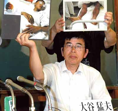 One man died and 43 other people were sickened by the toxic leak in Qiqihar, Heilongjiang province, on Aug 4, 2003. Since then, survivors and their families have had to live with the pain, both mental and physical.[File photo]