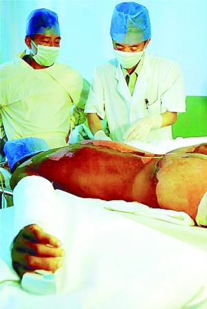 One man died and 43 other people were sickened by the toxic leak in Qiqihar, Heilongjiang province, on Aug 4, 2003. Since then, survivors and their families have had to live with the pain, both mental and physical.[File photo]