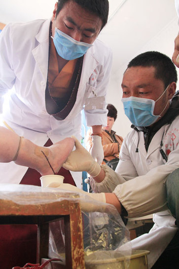 Tibetan monk-doctor Ngawang Thayi (left), 39, checks blood that was let out forcibly from a patient suffering from swollen feet caused by varicose veins. [Photo / China Daily]