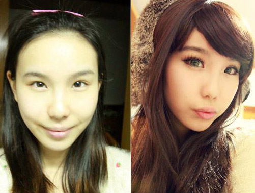 Young Chinese seek plastic surgery edge.[File photo] 