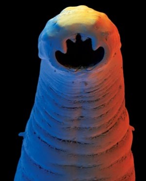 Hookworm, one of the 'Top 10 parasites inside the human body' by China.org.cn