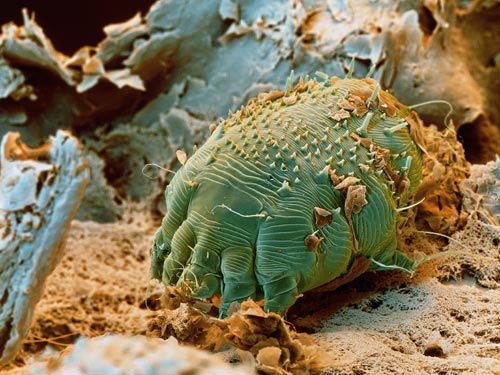 Sarcoptes scabiei, one of the 'Top 10 parasites inside the human body' by China.org.cn