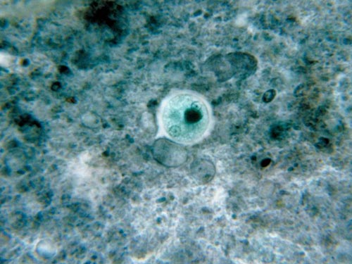 Entamoeba histolytica, one of the 'Top 10 parasites inside the human body' by China.org.cn