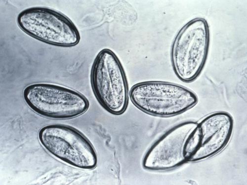 Pinworm, one of the 'Top 10 parasites inside the human body' by China.org.cn