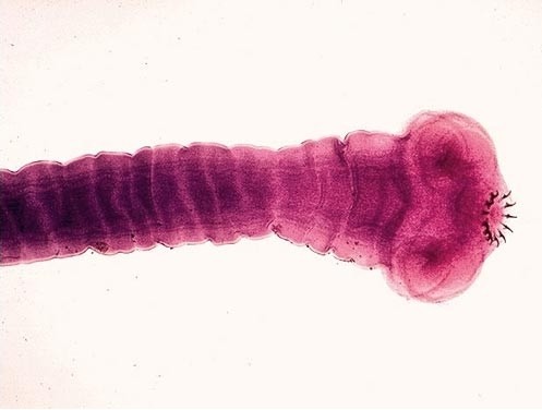 Tapeworm, one of the 'Top 10 parasites inside the human body' by China.org.cn