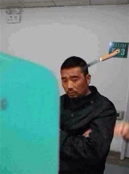 A photo of the man with a knife stuck in his head on Sina Weibo.