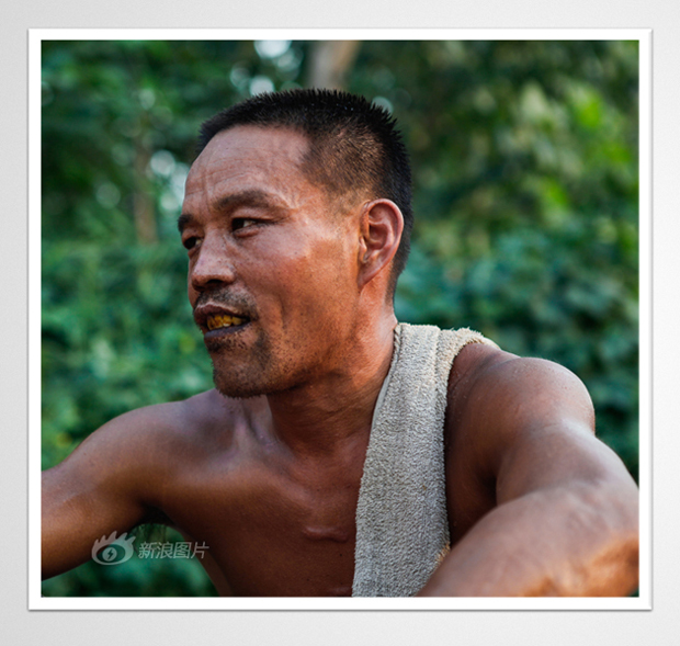 35-year-old Heiwa lives with his father. His mouth, chin and hands have small black speckles which he inherited from his mother. Many people in his village feel sorry for him, but at the same time think he looks disgusting. 10 years ago, his house burned down right after his mother's death. Later, his brother died of illness. His father became mentally unstable. [Sina photo]