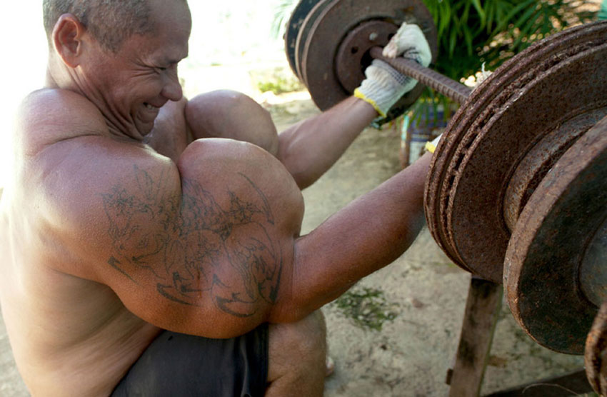 Real-life Popeye's huge arms from oil injections