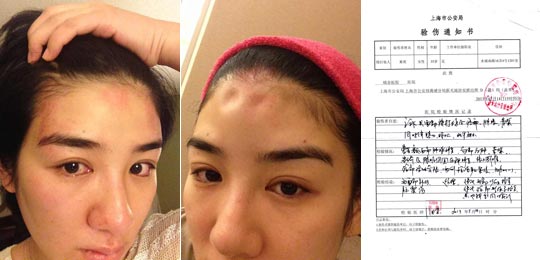 黄奕晒家暴照片_黄奕家暴_黄奕晒家暴照