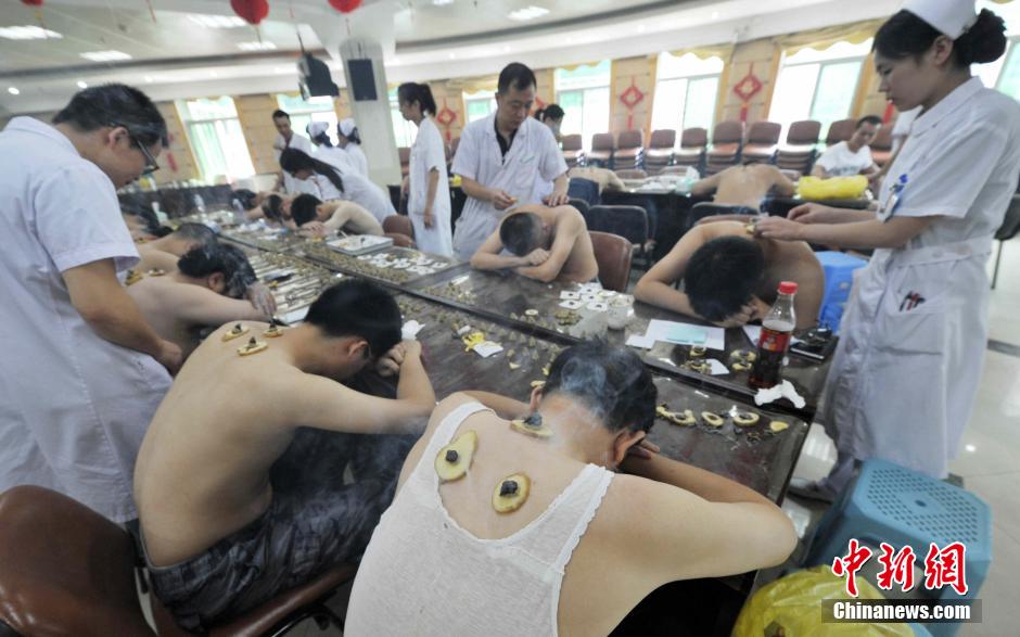 In this hot summer, a traditional Chinese therapy is very popular in Fuzhou, the capital of China's Fujian province. [Photo/Chinanews.com]