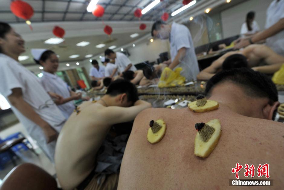 In this hot summer, a traditional Chinese therapy is very popular in Fuzhou, the capital of China's Fujian province. [Photo/Chinanews.com]