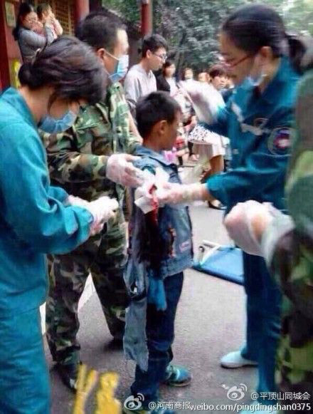 The entire right arm of the boy is bitten off by the bear. [Photo: Weibo]