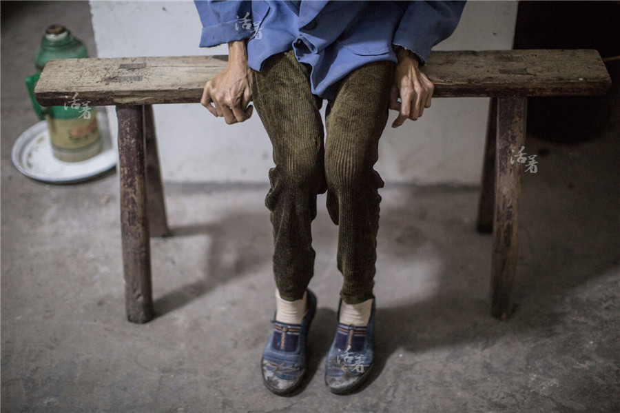 Generalized muscle atrophy has left Zhou skinny. She was diagnosed 26 years ago and later lost the ability to work. She was cared for by her family and inlaws. After the couple's parents all died, her husband gave up his job as a stonemason to stay at home, taking care of her.[Photo/news.qq.com]