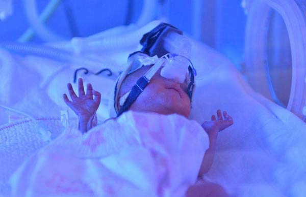  A baby in the incubator. [Photo/iqilu.com]