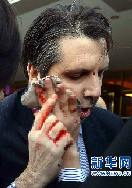 U.S. envoy to South Korea Mark Lippert was attacked by an armed man and injured in downtown Seoul on Thursday morning. [Photo/Xinhua]