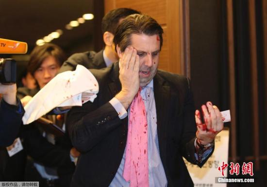 U.S. envoy to South Korea Mark Lippert was attacked by an armed man and injured in downtown Seoul on Thursday morning.
