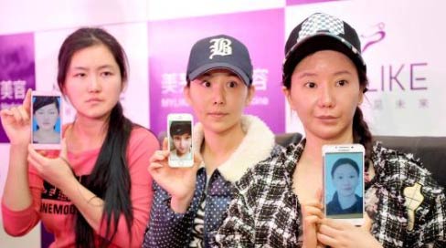 Three women experience failed cosmetic surgeries in South Korea. [File photo/cnr.cn] 