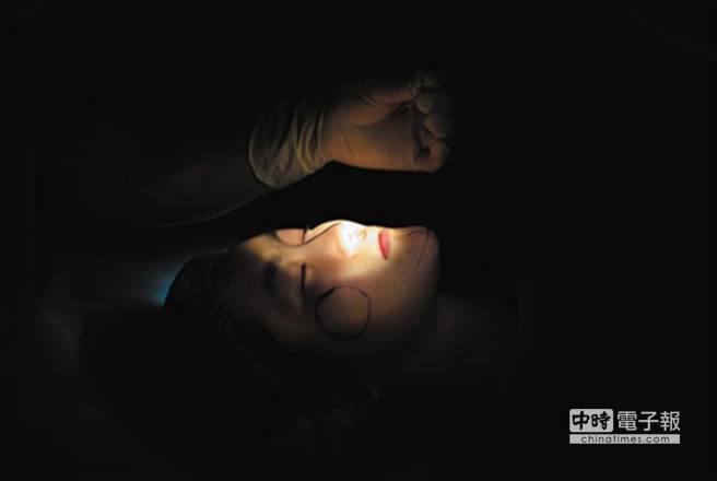 The long-lasting scars of plastic surgery