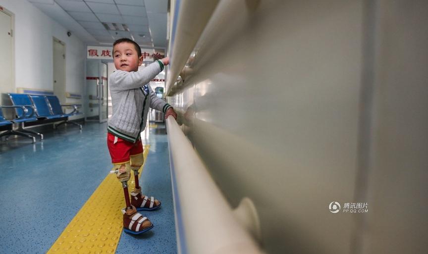 The little boy who won China's heart with his exuberant dance to the hit 'Little Apple' on a hospital bed despite losing both his legs is back – and now he has new legs.[Photo/qq.com] 