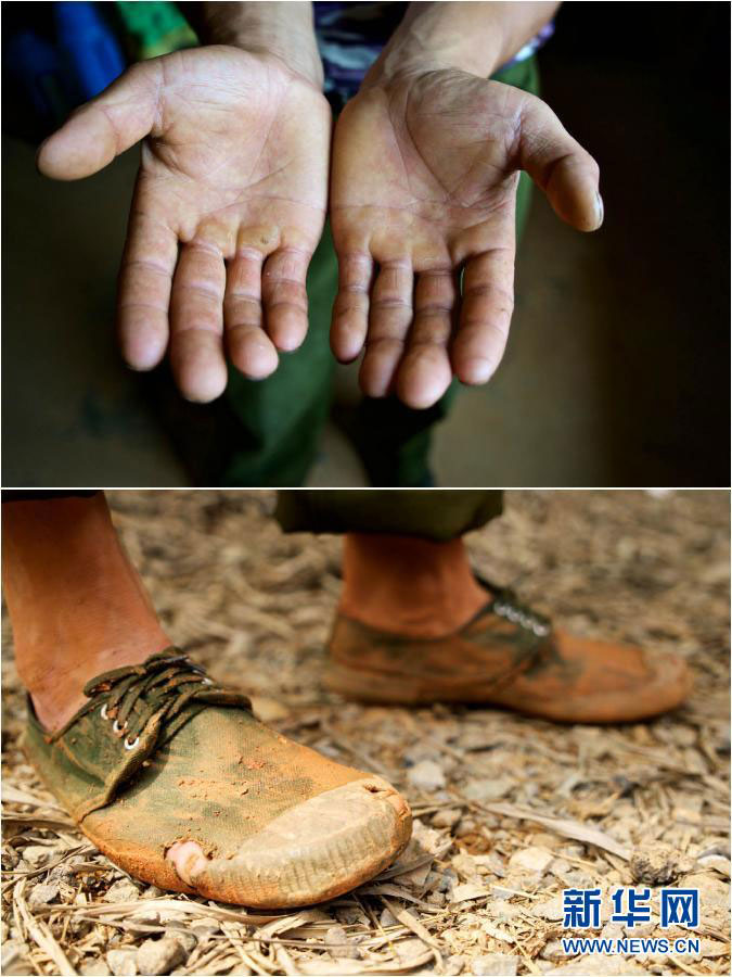 Photo (up) taken on May 5, 2015 shows Liu Hubin's coarse hands due to working on the farm. Photo (down) shows the sixth pair of shoes Liu has worn-out since setting up the farm. [Photo: Xinhua]