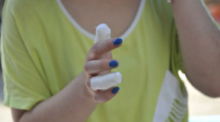 The woman's injured fingers. [Photo/weibo.com]