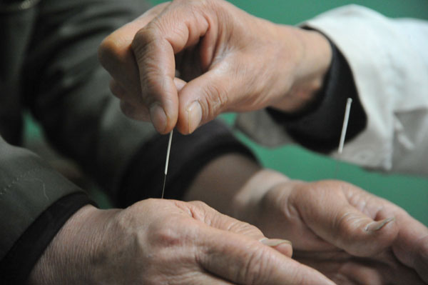 Acupuncture, a significant part of traditional Chinese medicine, has been widely used to treat a range of conditions in the country's TCM hospitals. [Photo provided to China Daily]