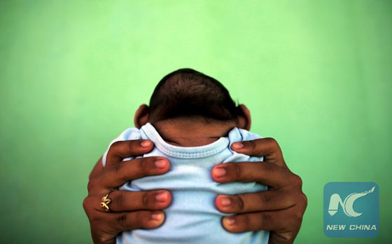 Jackeline, 26, holds her son who is 4-months old and born with microcephaly, in front of their house in Olinda, near Recife, Brazil, in this February 11, 2016. [Photo/Xinhua] 