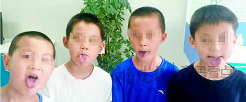 Eight children noticed their teeth, mouths and tongues turning black after swimming at a swimming pool in Tai'an city in east China's Shandong Province. [Photo: qlwb.com.cn]