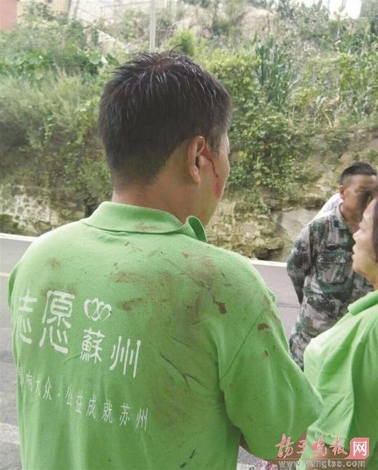 One of the injured volunteers with blood on his head. [Photo/Yangtse.com]