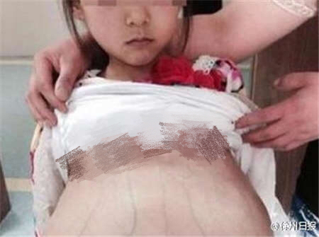 Chinese police are investigating a human trafficking case after a 12-year-old girl was brought to a hospital in Xuzhou City, China's eastern Jiangsu province, for a pregnancy test.