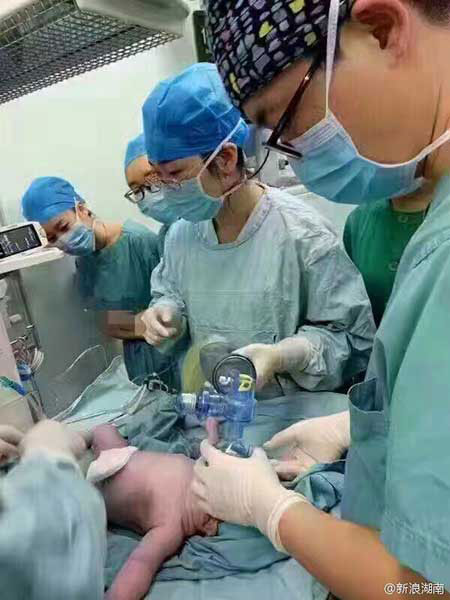 Medical staff members take care of the newborn.[Photo: Sina Weibo] 