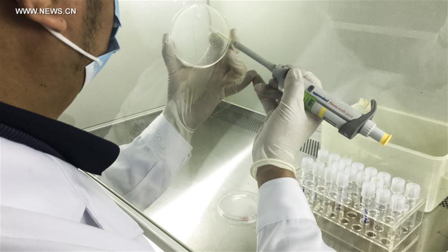 A researcher with BGI-Shenzhen tests the yeast in the experiment at BGI Research in Shenzhen, Guangdong province, March 10 2017.[Photo/Xinhua]