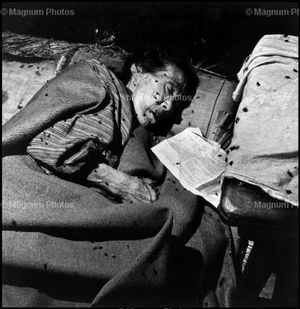 受到核辐射的日本平民