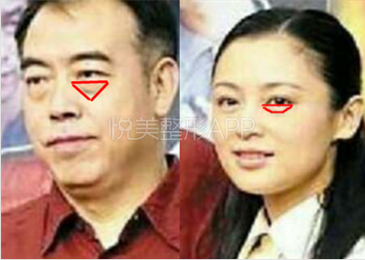 陈凯歌陈红夫妻示范 这就是卧蚕和眼袋的区别!_生活频道_中国网