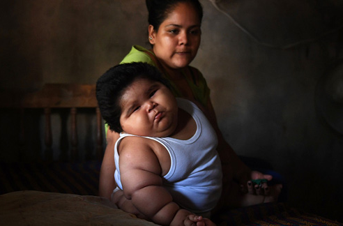 墨西哥：56斤！10个月的婴儿 9岁的体重