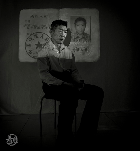 Wang Jian, 54. He was admitted to hospital on April 28, 2003, and discharged on May 12 of that same year. He has lost the capability to work and lives on the dole with his wife and son. He suffers from leg bone necrosis and pulmonary fibrosis.[Photo/Sina.com]