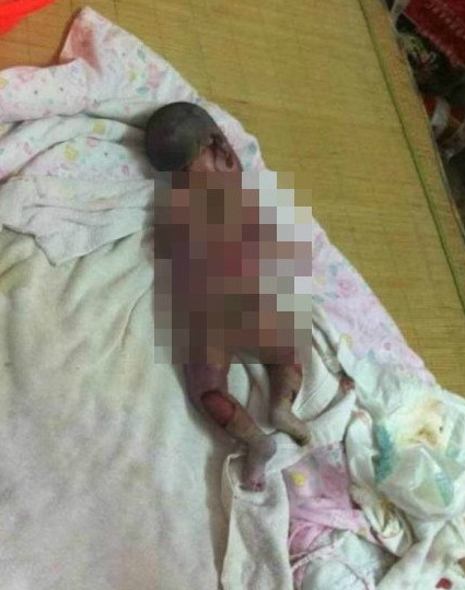 Hospital investigated over death of newborn.[Photo/Guangzhou Daily] 